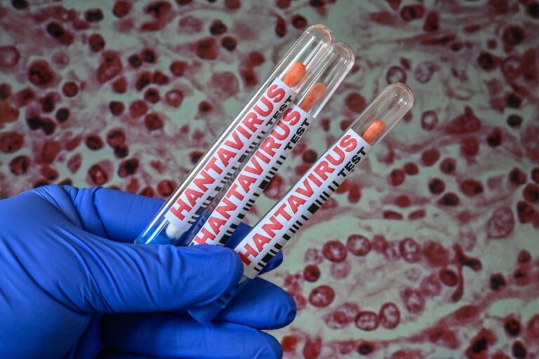 Les marchés de prédiction s’intéressent au hantavirus et au risque de pandémie